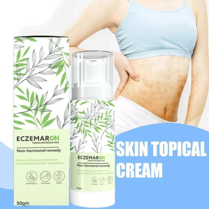 Eczemaron Anti Fungal Cream V Spray | Buy 1 Get 1 Free